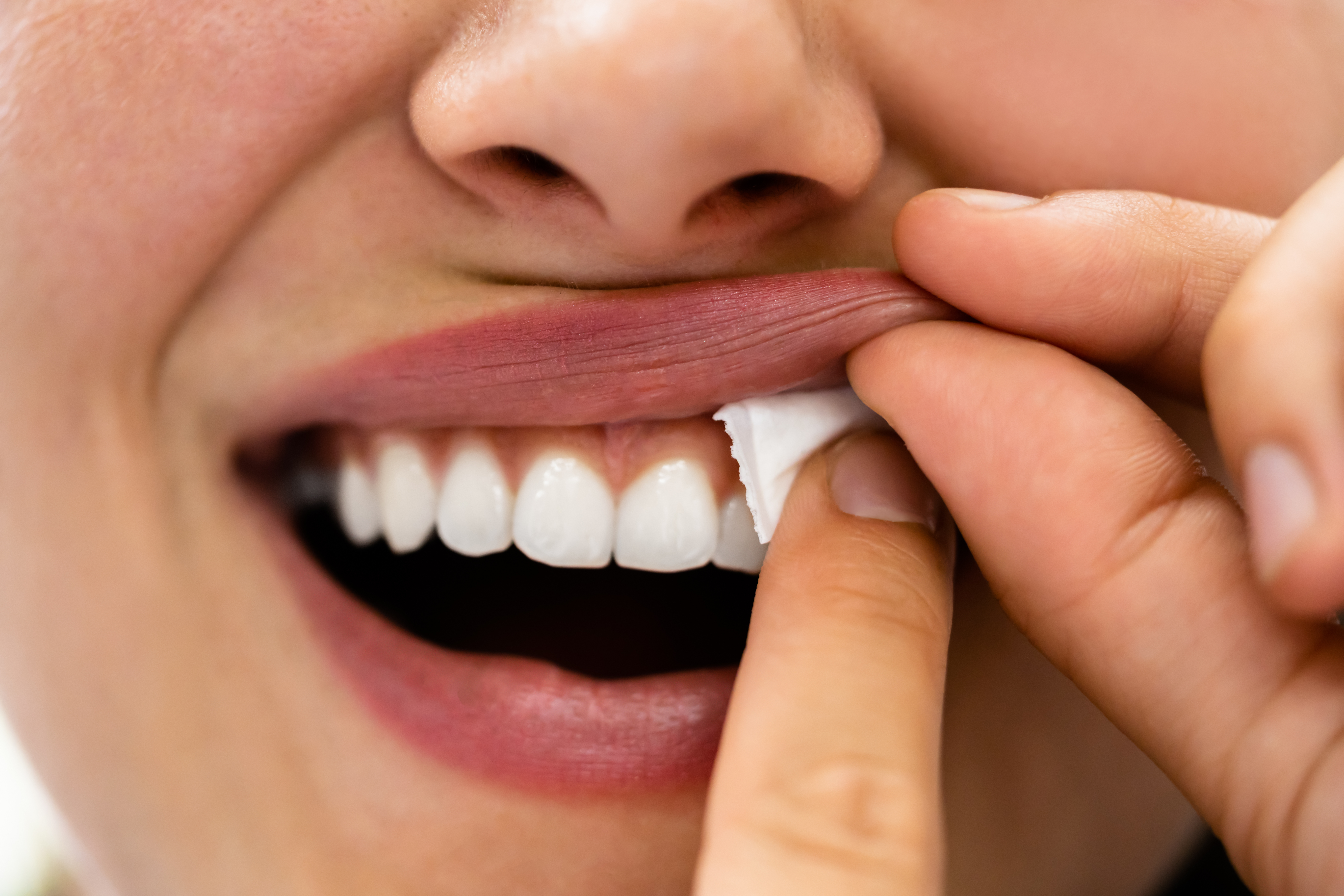 Woman,Chewing,Wet,Moist,Nicotine,Tobacco,Snus,Product